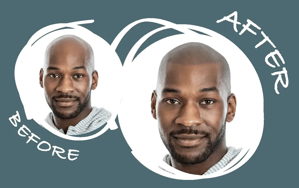 Before and after scalp micropigmentation hairline restoration on a male client in San Francisco